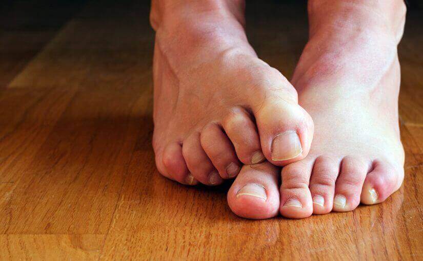 causes des champignons