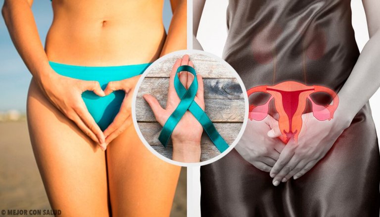 Ce que vous devez savoir sur le cancer des ovaires