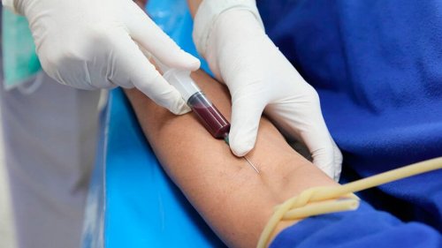 Comment diagnostiquer les symptômes du diabète.