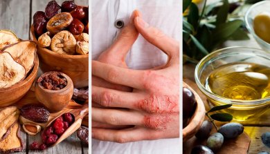 L'eczéma : causes, symptômes, diagnostic et traitement