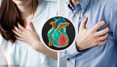 Les infarctus féminins et masculins sont-ils différents ?