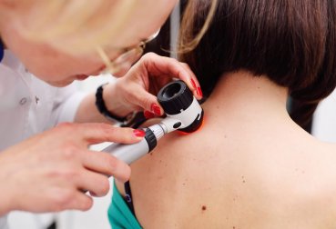 Le mélanome est-il le seul cancer de la peau ?