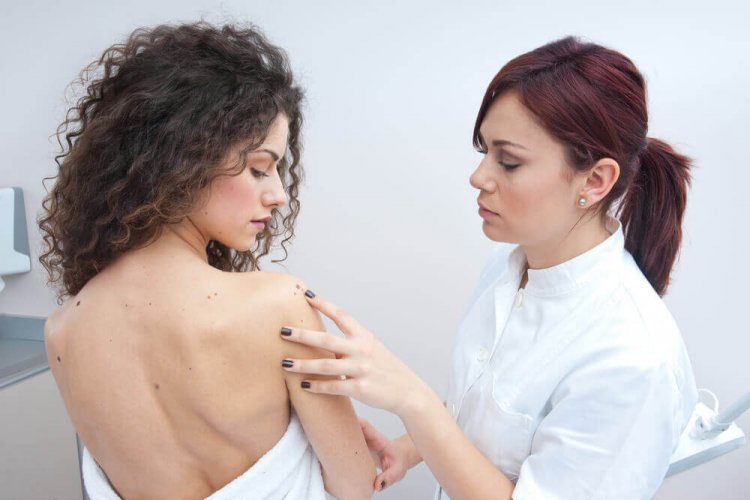 Mélanome et cancer de la peau.
