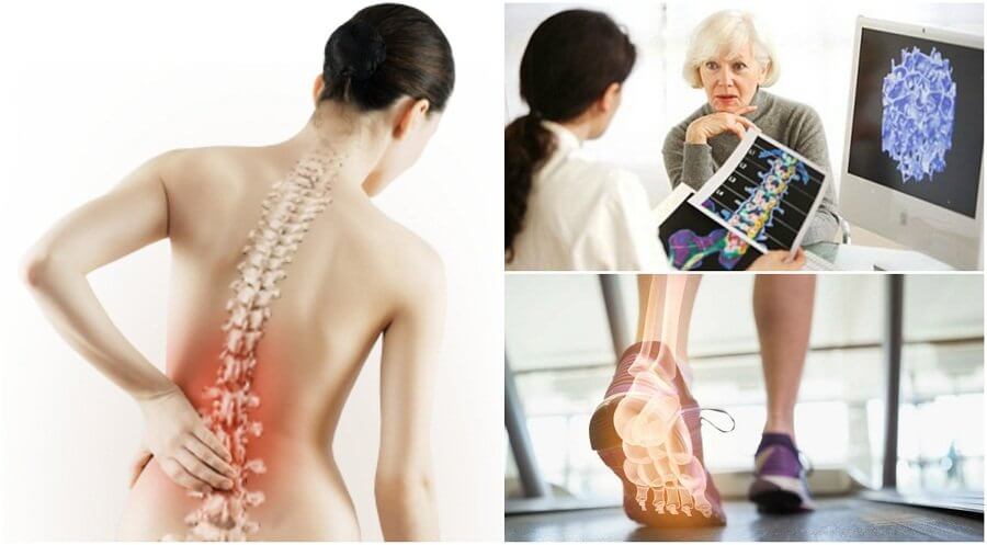 ostéoporose qui explique la douleur dans les omoplates 