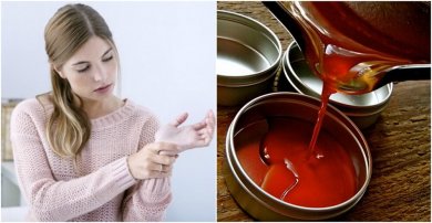 Pommades anti-inflammatoires au piment de Cayenne pour soulager les douleurs articulaires