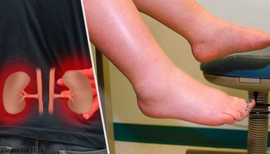 À quoi est due la rétention de liquides ?