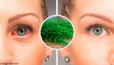 7 recommandations pour lutter naturellement contre la conjonctivite