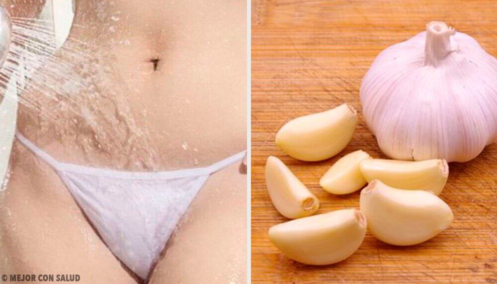 3 remèdes à base d’ail pour soigner les mycoses vaginales 3 remèdes à base d’ail pour soigner les mycoses vaginales