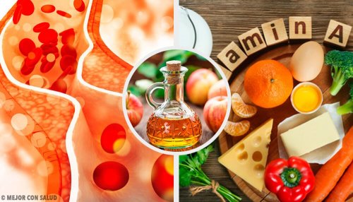 Les 7 propriétés du vinaigre de cidre pour maigrir