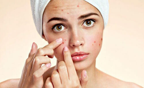 les savons naturels sont efficaces contre l'acné