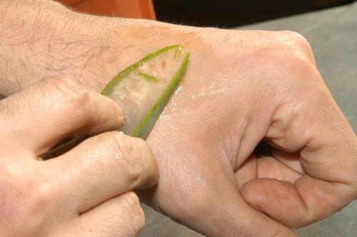 l'aloe vera aide votre peau à cicatriser