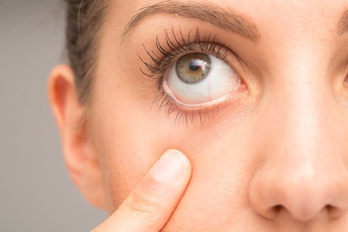 Inclure la carotte pour les problèmes oculaires.