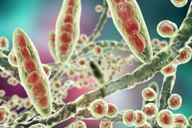 Apprenez à traiter les mycoses des pieds avec des remèdes maison