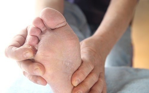 le pied d'athlète