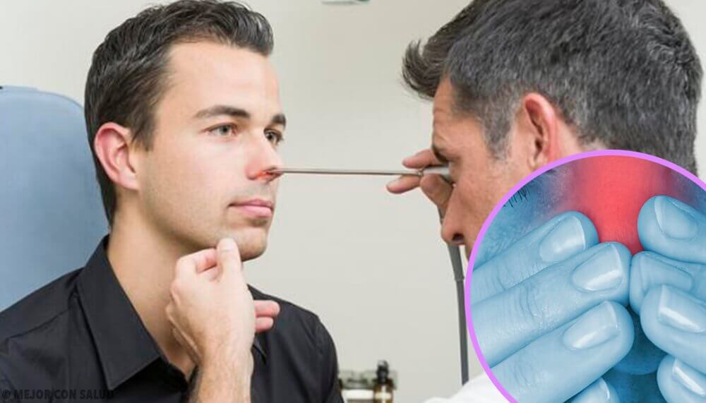 remèdes à base de betteraves contre la rhinite