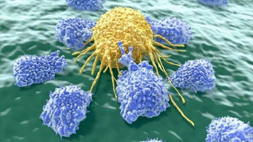 Les 5 types de cancers les plus fréquents chez les femmes