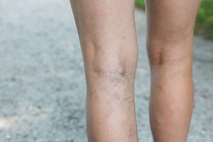 améliorer votre circulation sanguine