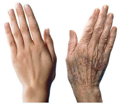 7 conseils pour prévenir le vieillissement des mains