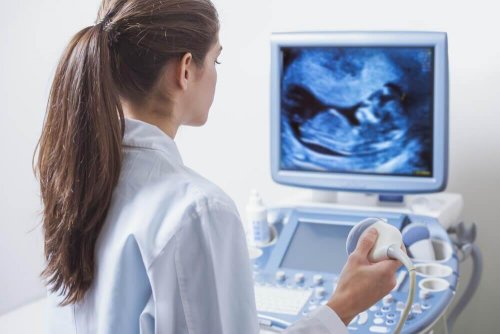 Femme qui regarde une échographie