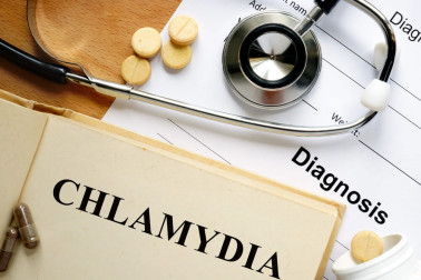 Existent-ils des remèdes naturels efficaces contre la chlamydia