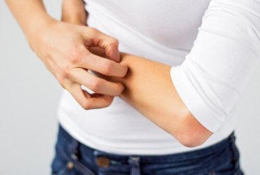 Les 10 allergies cutanées les plus communes