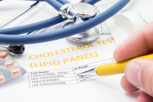 Régime efficace pour réduire le mauvais cholestérol