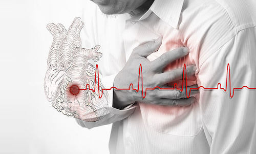 Faire trop d'exercice physique peut affaiblir le coeur