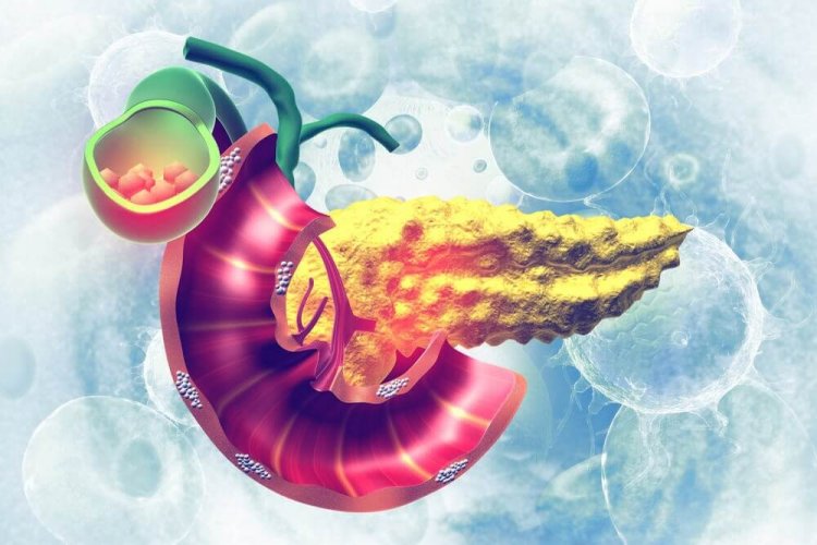 Régime après une cholécystectomie ou une ablation de la vésicule