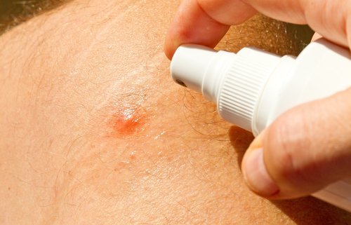 Femme qui applique un répulsif pour prévenir les piqûres de moustiques