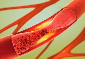 Comment prendre soin de sa santé artérielle : 6 habitudes saines