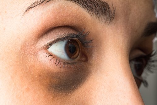comment atténuer les cernes ?