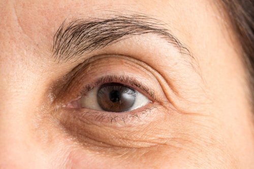 Comment atténuer les cernes : 5 méthodes naturelles