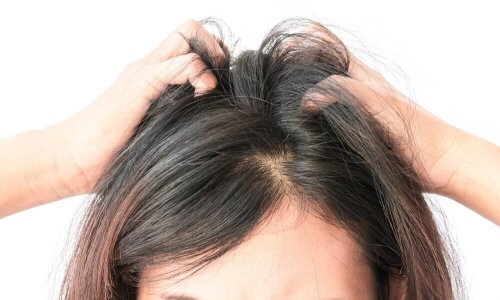Irritation Cuir Chevelu Et Chute De Cheveux - Conseils Cheveux