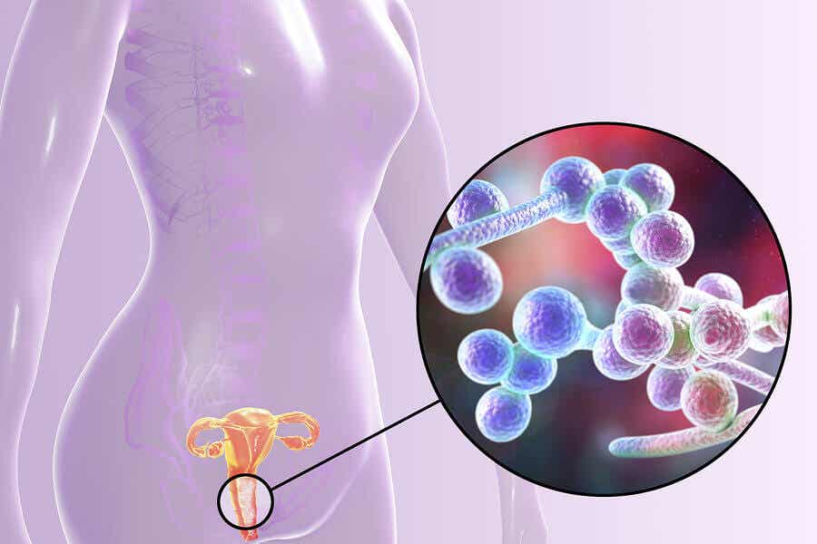 odeurs vaginales