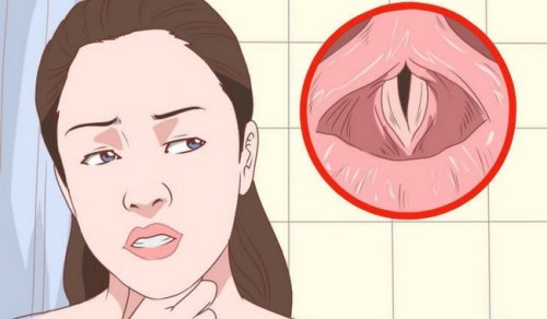 traiter la laryngite avec un bain de bouche