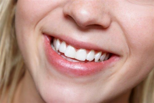 Sourire avec des dents blanches