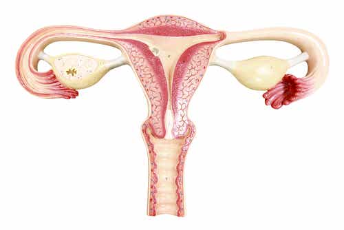 cancer de l'ovaire