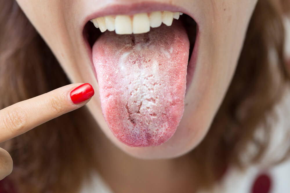 Halitosis: 3 remedios naturales a base de menta TodoSALUD