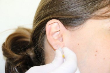 L'auriculothérapie pour traiter la maladie de Parkinson