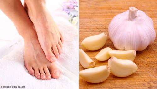 Une gousse d'ail pour soulager un ongle incarné