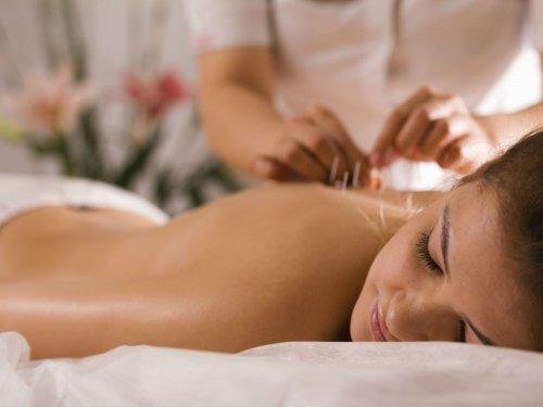 séance d'acupuncture