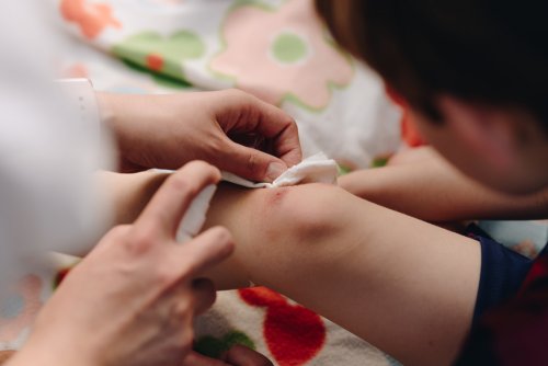 techniques pour soigner une plaie