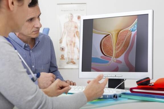 Quels sont les traitements de l’hyperplasie de la prostate ?