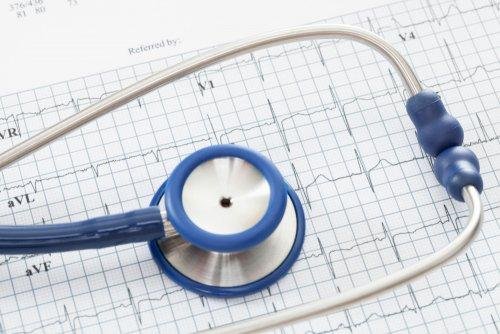 activité cardiaque et fibrillation auriculaire