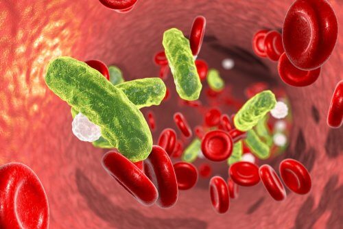 infection néonatale et septicémie