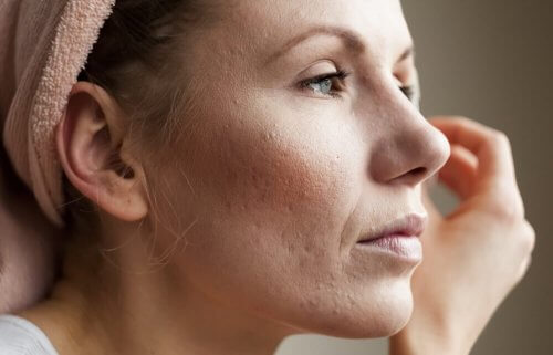 8 conseils pour resserrer les pores dilatés