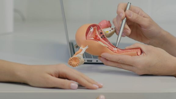 Traitement du syndrome des ovaires polykystiques