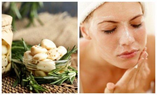 5 remèdes à l'ail pour traiter les problèmes d'acné