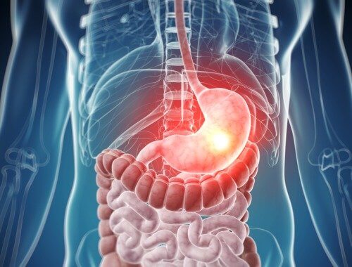 Quelles sont les principales intolérances alimentaires ?