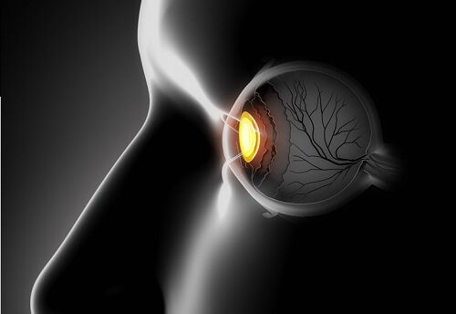 Strabisme : symptômes et traitements